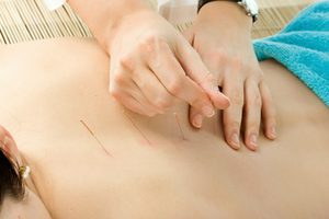 Fully Integrating Medical Acupuncture Into Family Medicine